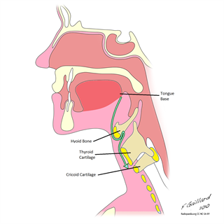 thyroglossal duct cyst anatomy
